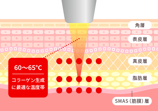 60～65度。コラーゲン生成に最適な温度帯